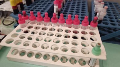 Photo of Oddaj krew dla Zuzi w Wolborzu i Gorzkowicach