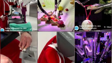 Photo of Świąteczna precyzja w szpitalu w Bełchatowie. Robot Da Vinci w roli pomocnika św. Mikołaja!